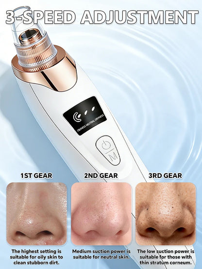 Professional Blackhead Vacuum - Rechargeable Pore Extractor for Blackheads, Oily Skin & Facial Cleansing