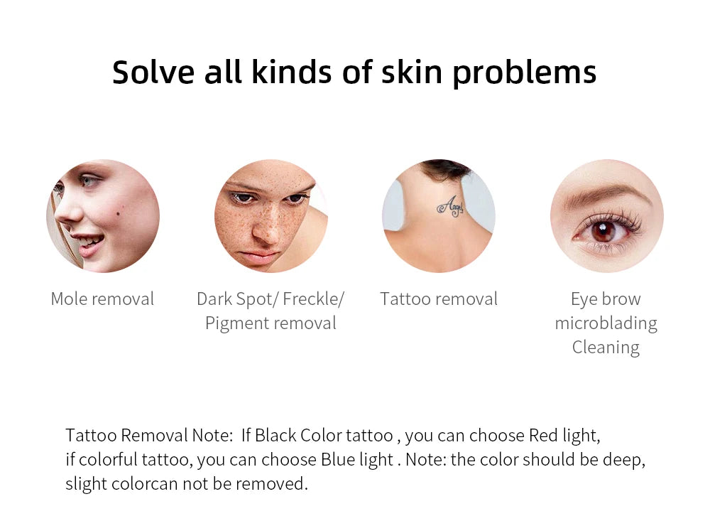 Picosecond Laser Pen Freckle Tattoo Removal Dark Spot Remover Blue & Red Light Machine Portable Scar Mole Remover Beauty Care