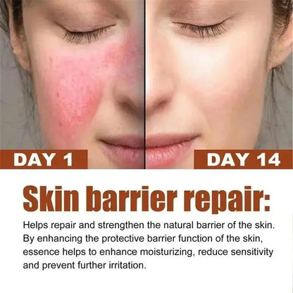 B5 Repair Facial Redness Cream Instant Spider Vein Remove Sensitive Skin Sooth Anti Redness Rosacea Treat Lotion Korean Cosmetic