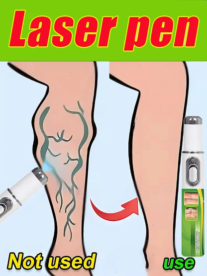 Blue light laser pen, providing you with a comfortable experience