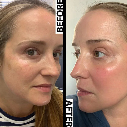 Hoygi Niacinamide Facial Serum Vitamin B3 Wrinkles Pigment Dark Spot Removal Correcting Glow Serum Face Whitening Moisturizer