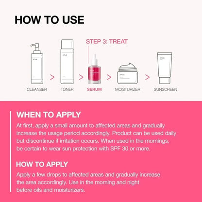 Anua Niacinamide 10%+TXA 4% Melasma and Dark Spot Remover Whitening Antioxidant Serum 30ML Spot Remover Korea Skincare Products