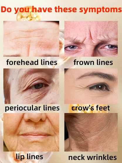 Wrinkle Disappear, Reverse Aging, Instant Wrinkle Free Ageless