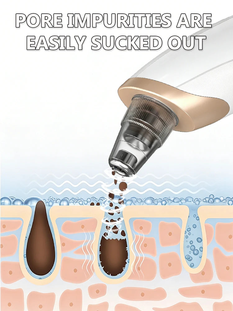 Professional Blackhead Vacuum - Rechargeable Pore Extractor for Blackheads, Oily Skin & Facial Cleansing