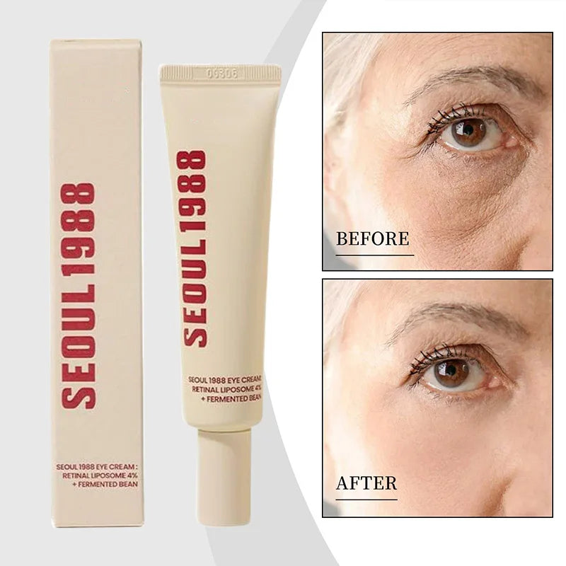 1988 Retinol Eye Cream Anti-wrinkle Firm Skin Fade Fine Lines Anti Dark Circle Puffiness Brighten Skin Seoul 1988 Eye Cream Set
