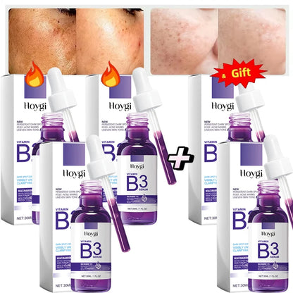 Hoygi Niacinamide Facial Serum Vitamin B3 Wrinkles Pigment Dark Spot Removal Correcting Glow Serum Face Whitening Moisturizer