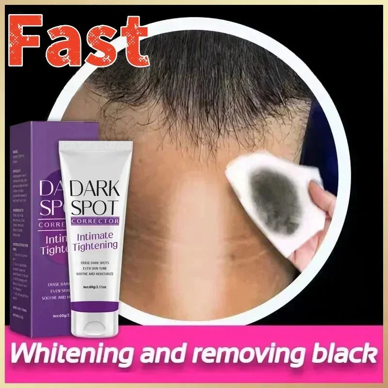 Body Whitening Cream Private Parts Underarm Knee Thigh Inner Melanin Bleaching Brighten Lotion Dark Skin Healthy White Body Care