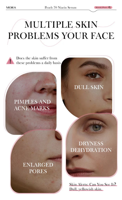 Niacinamide Serum Dark Spot Correcting Moisturizing Brightening Cleaning Pores Fade Fine Lines Makeup Remover Korean Skin Care