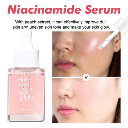 Niacinamide Serum Dark Spot Correcting Moisturizing Brightening Cleaning Pores Fade Fine Lines Makeup Remover Korean Skin Care