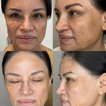 Hoygi Niacinamide Facial Serum Vitamin B3 Wrinkles Pigment Dark Spot Removal Correcting Glow Serum Face Whitening Moisturizer