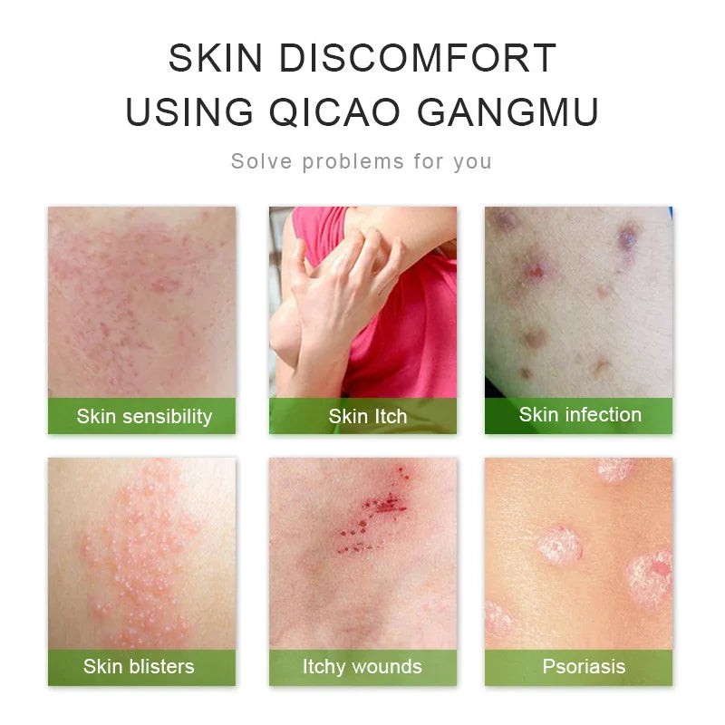 2/5/10PCS Skin Psoriasis Cream Dermatitis Eczematoid Eczema Ointment Treatment Natural Anti-itch Day and Night Medication Scalp