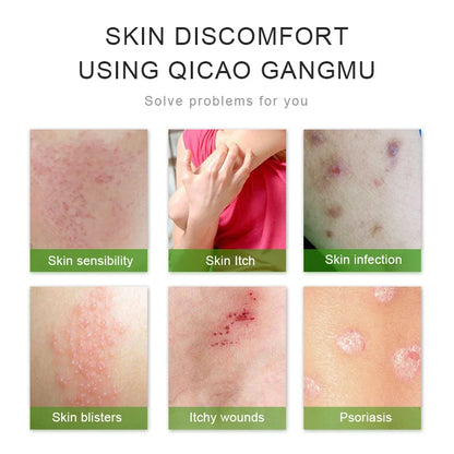 2/5/10PCS Skin Psoriasis Cream Dermatitis Eczematoid Eczema Ointment Treatment Natural Anti-itch Day and Night Medication Scalp