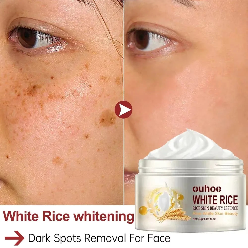 White Rice Whitening Cream Remove Dark Spots Fade Freckle Melanin Repair Product Anti Wrinkle Moisturizing Brighten Facial Care