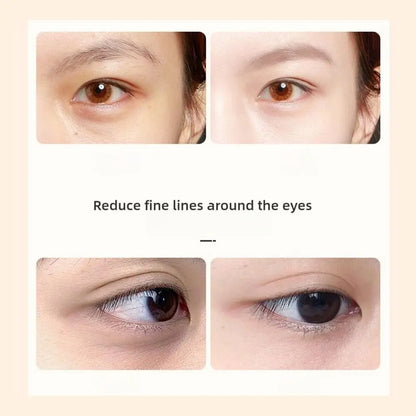 8ML VC Lutein Eye Essence Oil Eye Roller Ball Removes Dark Circles Dullness Eraser Eye Bag Fade Fine Line Nourishing Eye Care