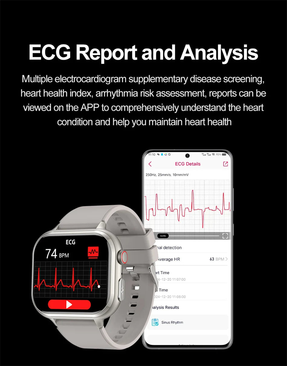 2025 Medical Grade ECG+PPG Smart Watch – Blood Sugar & Health Monitor