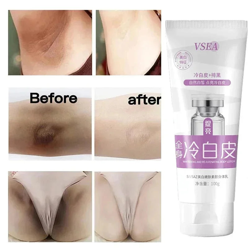 Body Whitening Cream Private Parts Underarm Knee Thigh Inner Melanin Bleaching Brighten Lotion Dark Skin Healthy White Body Care