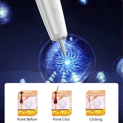 Laser Plasma Pen Mole Wart Skin Tag Remover Black Dots Freckle Dark Spot Wart Eliminator Papilloma Nevus Remover Plasma Pen