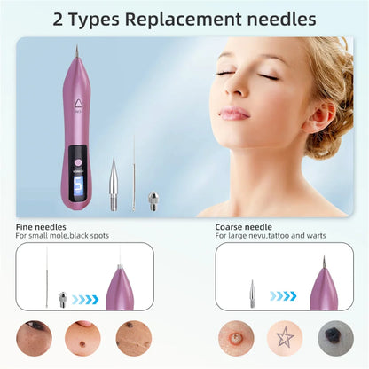 Laser Plasma Pen 9 Levels Freckle Remove Pen Wart Remover Tattoo Remover Instruments Skin Tag Removal Spot Beauty Care Tool