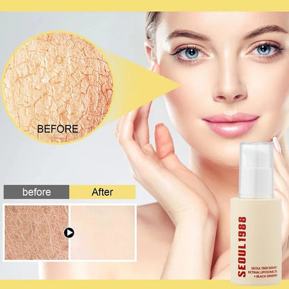 Seoul 1988 Korean Skin Care Set Snail Mucin Eye Contour Care Vitamin C Retinol Dark Circles Removal Seoul 1988 Korean Cosmetics