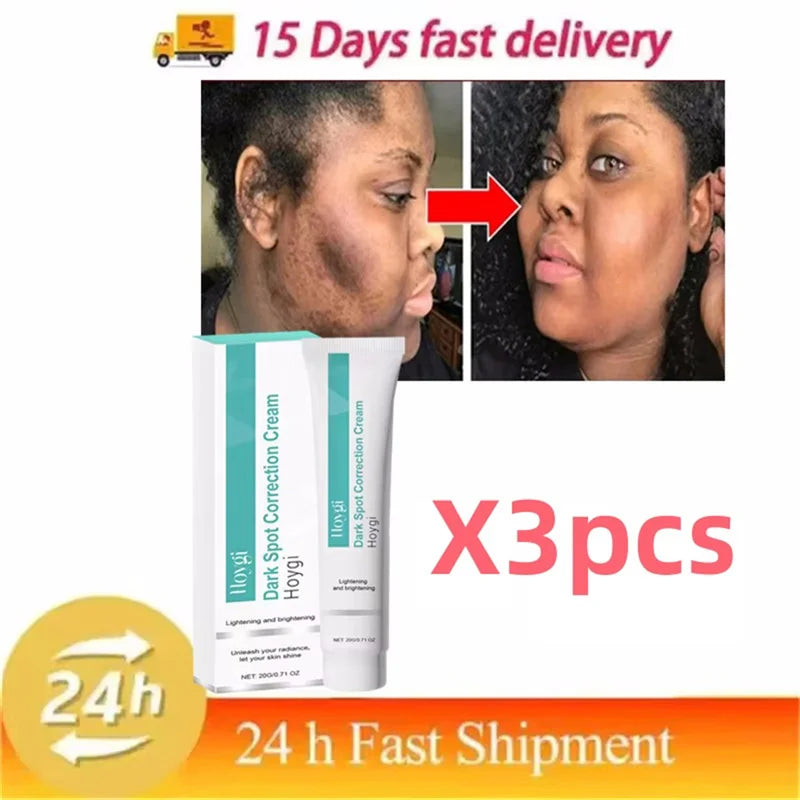 Powerful Spot-removing Whiten Cream Brighten Skin Fast Eliminates Melanin Pigmentation Melasma Dark Spots Moisturize Beauty Gel