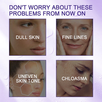 Hoygi Niacinamide Facial Serum Vitamin B3 Wrinkles Pigment Dark Spot Removal Correcting Glow Serum Face Whitening Moisturizer