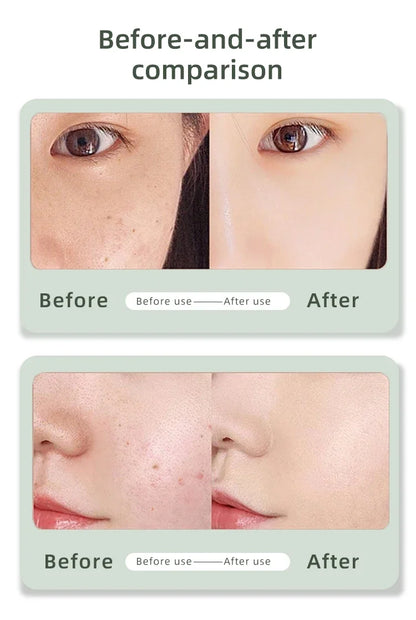 Portable 2 In 1 Plasma Ozone For Acne Beauty Plasma Laser Pen For Eye Lift Wrinkle Removal spot Removal Pen mole Remover Pen