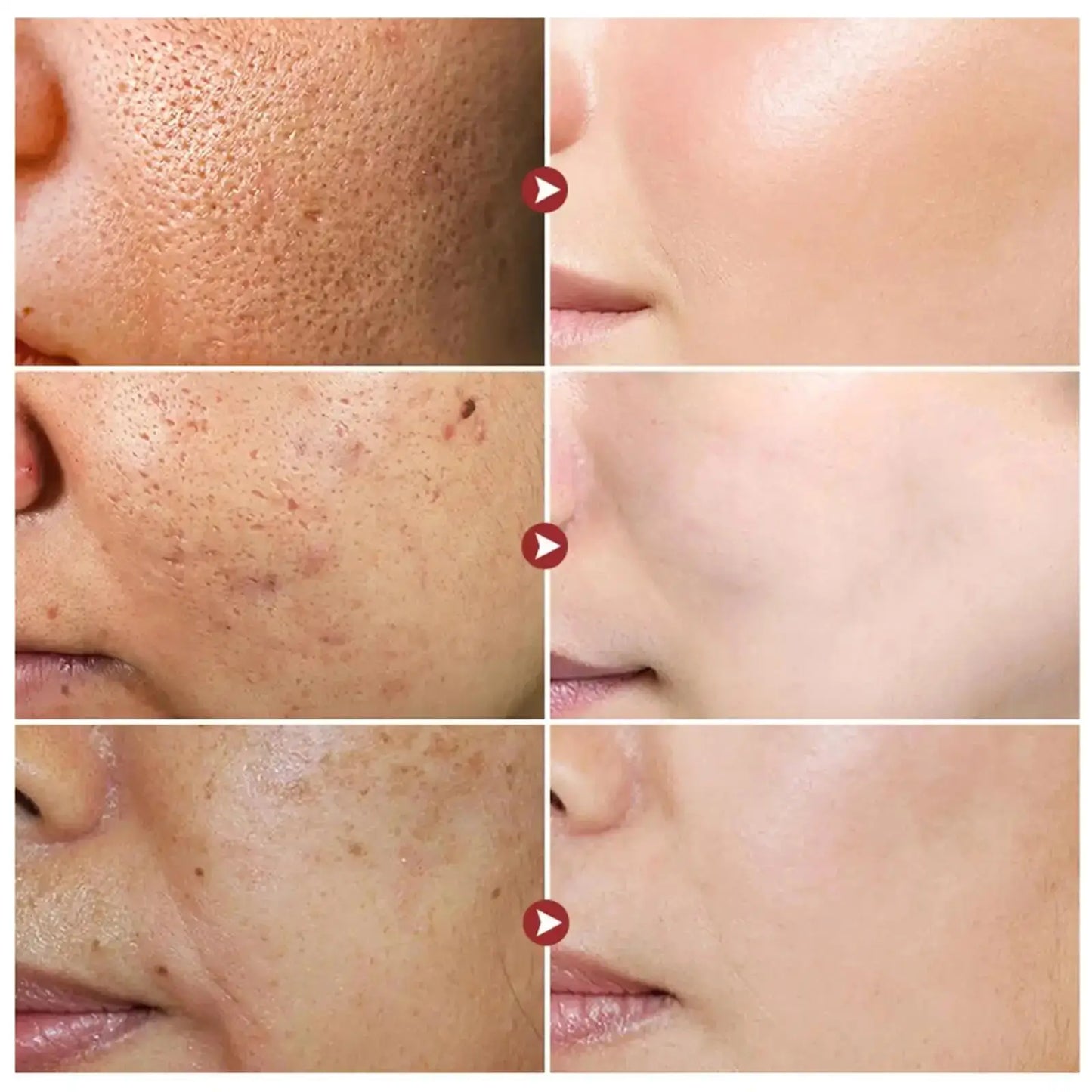 White Rice Whitening Cream Remove Dark Spots Fade Freckle Melanin Repair Product Anti Wrinkle Moisturizing Brighten Facial Care