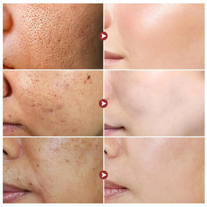 White Rice Whitening Cream Remove Dark Spots Fade Freckle Melanin Repair Product Anti Wrinkle Moisturizing Brighten Facial Care