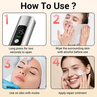 Laser Plasma Pen Mole Wart Skin Tag Remover Black Dots Freckle Dark Spot Wart Eliminator Papilloma Nevus Remover Plasma Pen