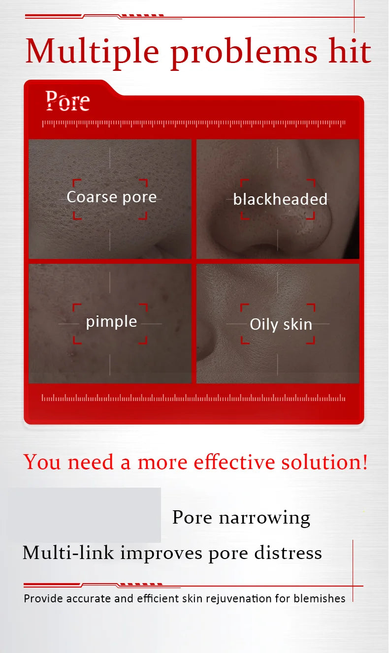 Pore Minimizing Serum Acid Shrink Pores Removing Large Pores Blackheads face Moisturizing Brightning Skin Care Essence Oil