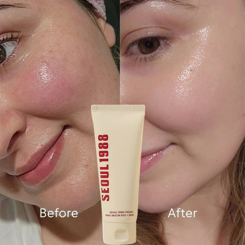 Seoul 1988 Korean Skin Care Set Snail Mucin Eye Contour Care Vitamin C Retinol Dark Circles Removal Seoul 1988 Korean Cosmetics