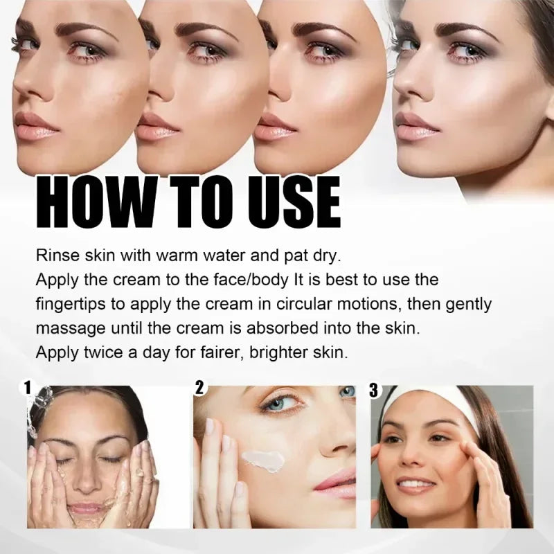 Effective whitening cream for freckles, removes Melasma, dark spots, pigmentation, moisturizer, lightens the face,