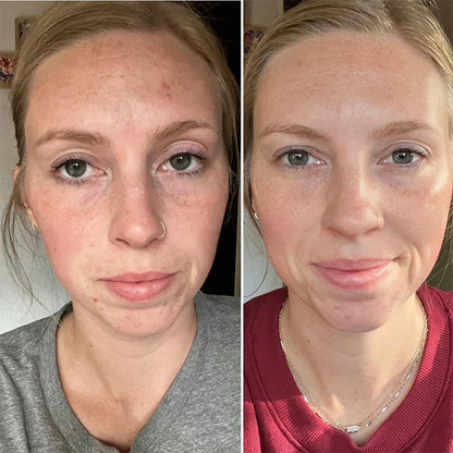 Hoygi Niacinamide Facial Serum Vitamin B3 Wrinkles Pigment Dark Spot Removal Correcting Glow Serum Face Whitening Moisturizer