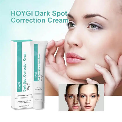 Powerful Spot-removing Whiten Cream Brighten Skin Fast Eliminates Melanin Pigmentation Melasma Dark Spots Moisturize Beauty Gel