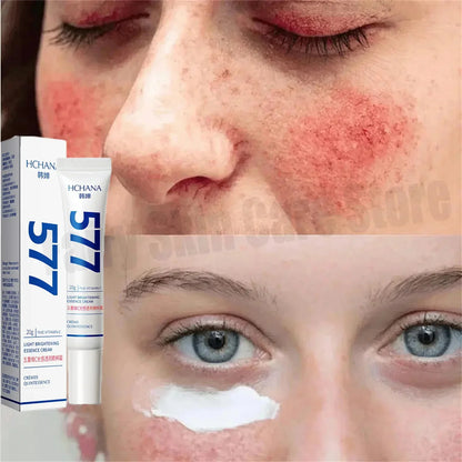 Repair Facial Redness Cream Instant Spider Vein Remove Sensitive Skin Sooth Anti Redness Rosacea Treat Lotion Korean Cosmetics