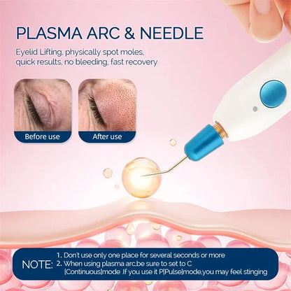 Plasma Pen Cold Skin Tag Wart Remover Dark Spot Fibroblast Therapy Eye Lift Skin Tightening Beauty Device