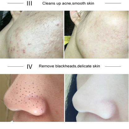 Green Tea Solid Mask Deep Cleansing Pores Shrinking Remove Blackhead Anti Acne Blemish Refreshing Mud Mask Brightening Skin Care