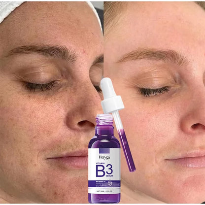 Hoygi Niacinamide Facial Serum Vitamin B3 Wrinkles Pigment Dark Spot Removal Correcting Glow Serum Face Whitening Moisturizer