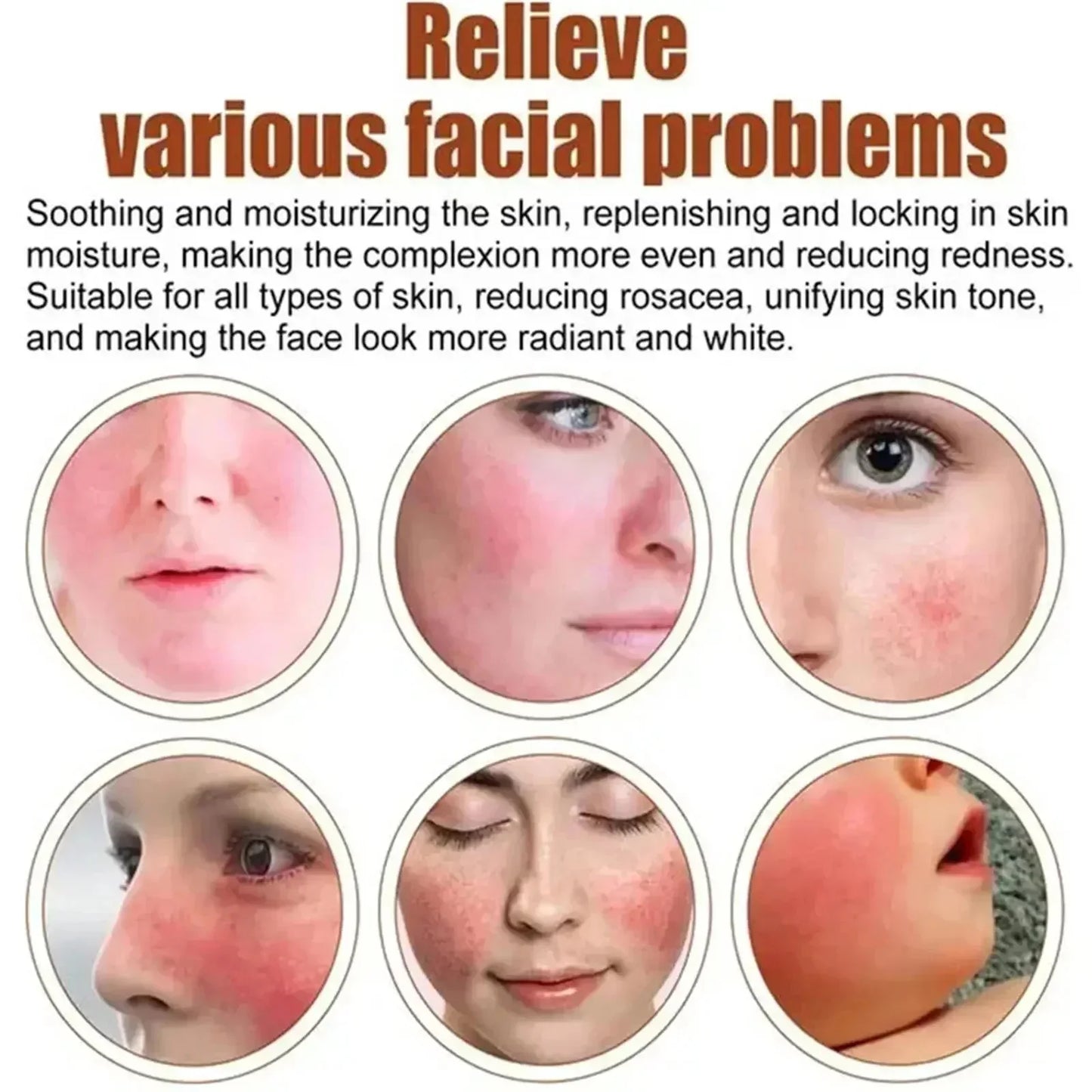 Repair Facial Redness Cream Instant Spider Vein Remove Sensitive Skin Sooth Anti Redness Rosacea Treat Lotion Korean Cosmetics