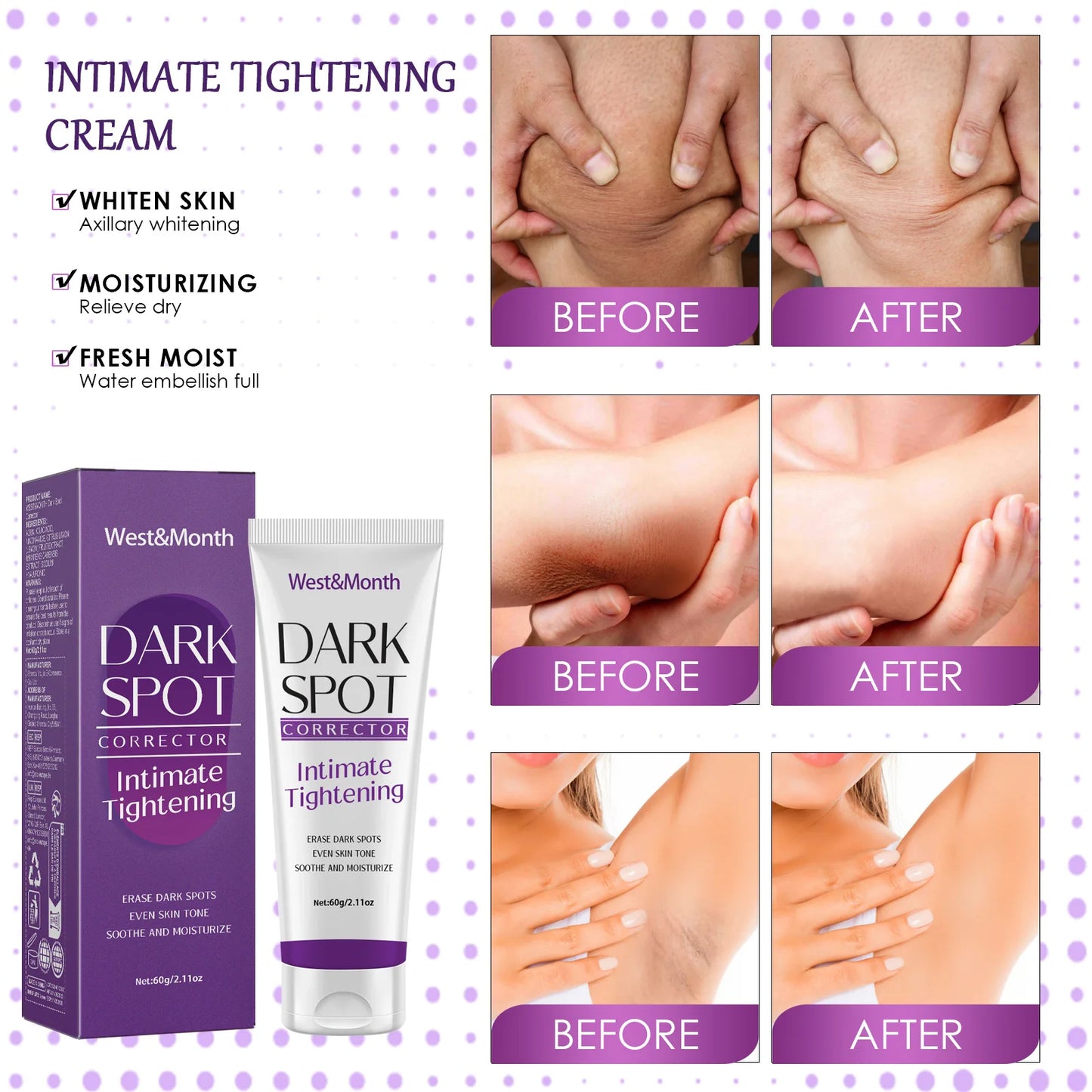 Body Whitening Lotion Dark Spot Remover For Underarms Knees Elbows Melanin Bleaching Lightening Skin Moisturizing Cream 60g