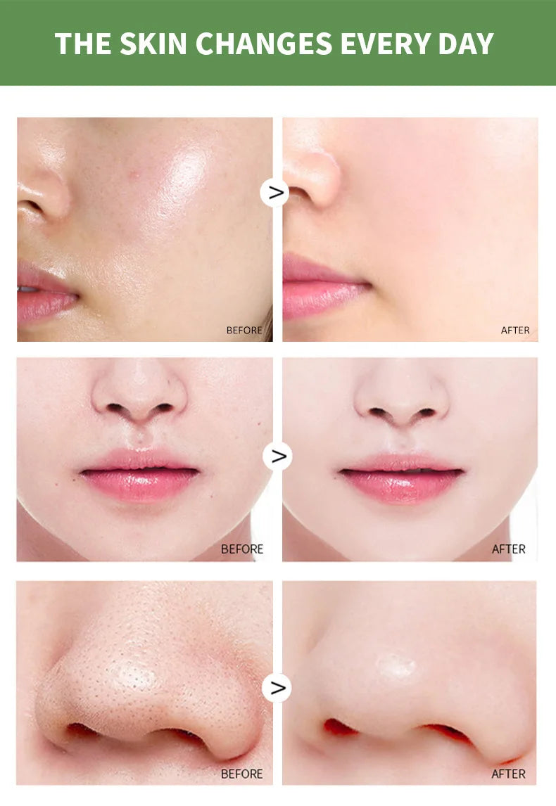 Green Tea Solid Mask Deep Cleansing Pores Shrinking Remove Blackhead Anti Acne Blemish Refreshing Mud Mask Brightening Skin Care