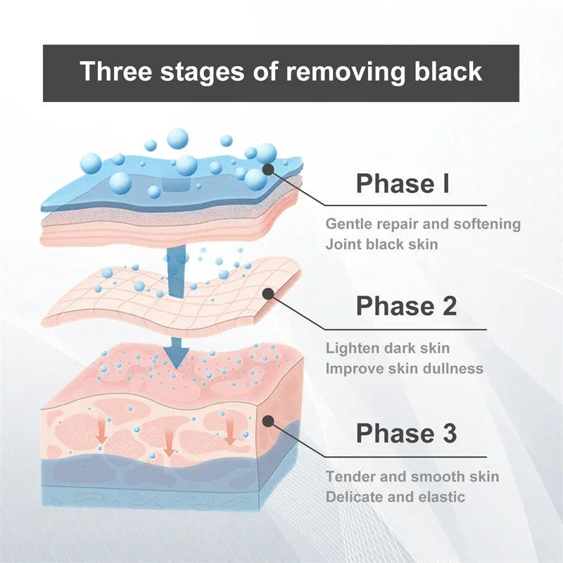 Whitening Cream Private Parts Underarm Bleaching Serum Whiten Butt Knee Brighten Inner Thigh Intimate Parts Dark Remove Melanin