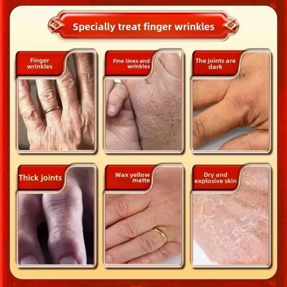 Anti-Wrinkle Hand Cream – Smoothing & Nourishing Cream for Finger Joints & Rough Skin