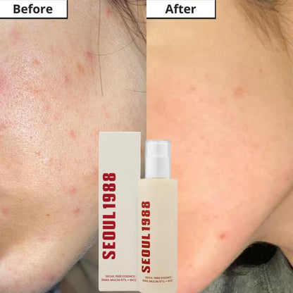 Seoul 1988 Korean Skin Care Set Snail Mucin Eye Contour Care Vitamin C Retinol Dark Circles Removal Seoul 1988 Korean Cosmetics