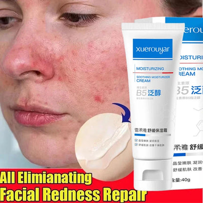 B5 Repair Facial Redness Cream Instant Spider Vein Remove Sensitive Skin Sooth Anti Redness Rosacea Treat Lotion Korean Cosmetic
