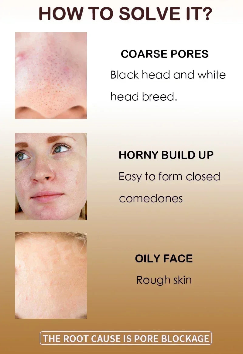 Pore Minimizing Serum Acid Shrink Pores Removing Large Pores Blackheads face Moisturizing Brightning Skin Care Essence Oil