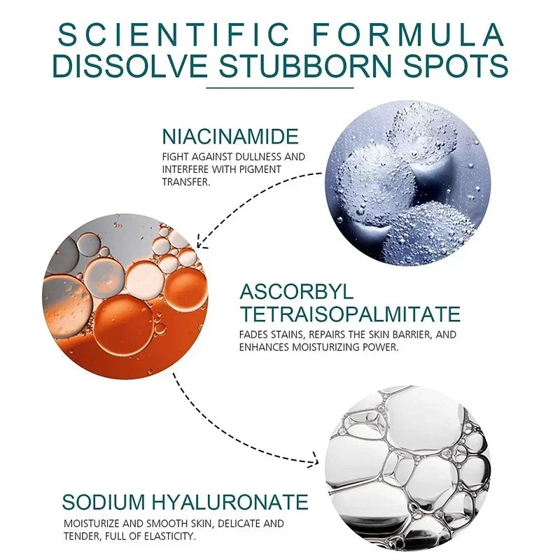 Effective whitening cream for freckles, removes Melasma, dark spots, pigmentation, moisturizer, lightens the face,