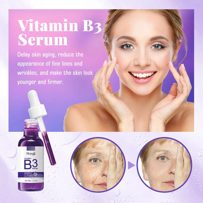 Hoygi Niacinamide Facial Serum Vitamin B3 Wrinkles Pigment Dark Spot Removal Correcting Glow Serum Face Whitening Moisturizer