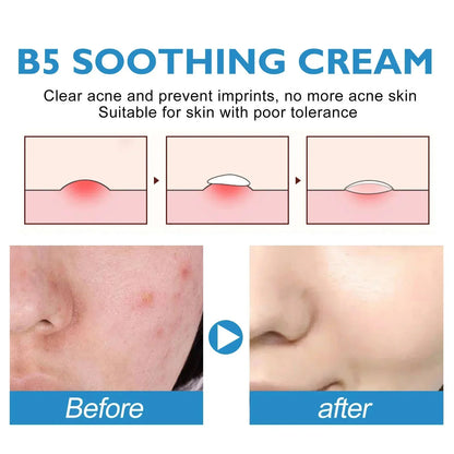 Repair Facial Redness Cream Instant Spider Vein Remove Sensitive Skin Sooth Anti Redness Rosacea Treat Lotion Korean Cosmetics