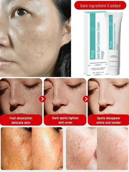 Powerful Spot-removing Whiten Cream Brighten Skin Fast Eliminates Melanin Pigmentation Melasma Dark Spots Moisturize Beauty Gel